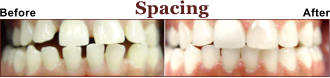 Do You Have a Spacing Problem? Fill Out The Form So We Can Help You.