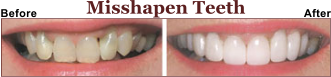 Embarresed of Your Teeth? We Can Help.